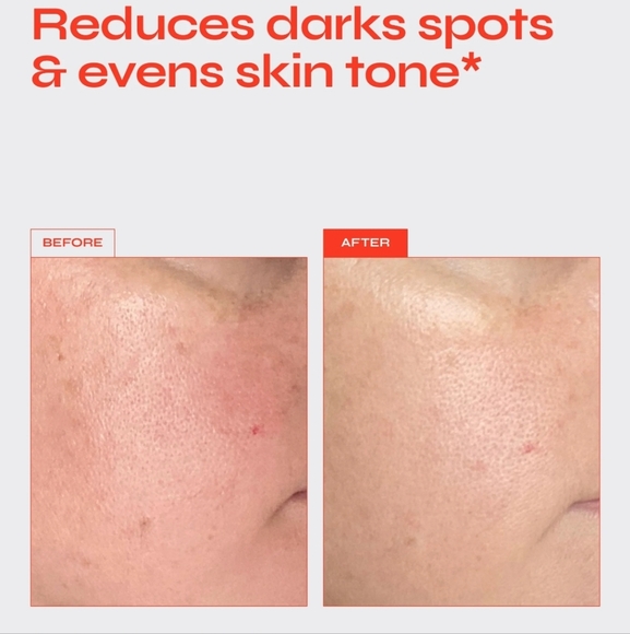 NIB FACILE BRIGHTEN TARGETED PIGMENT SERUM - Picture 6 of 16